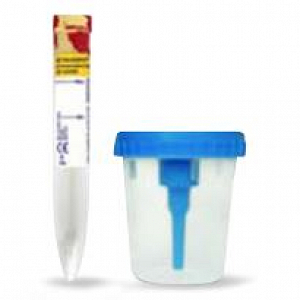 BD Vacutainer Urine Collection Kits: Urinalysis:Clinical Specimen Collection:Urine