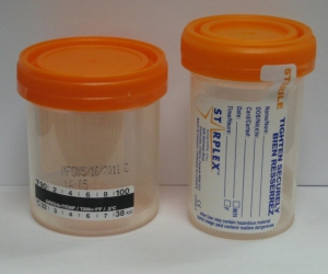 Specimen Containers with Temperature Strip