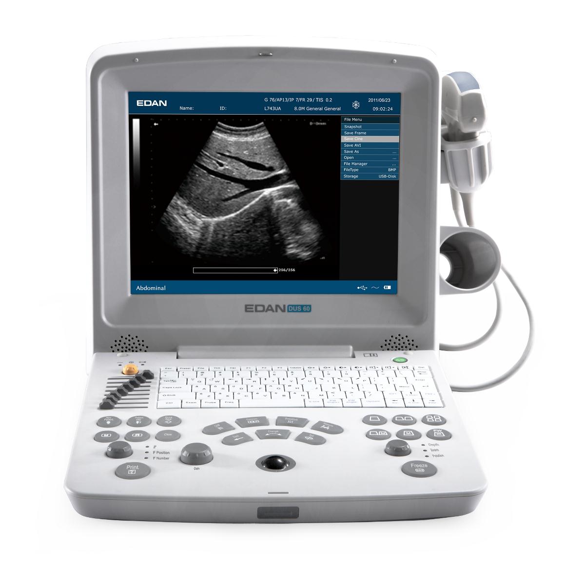 Nuevo scanner de ultrasonidos en Dermomedic - Dermomedic