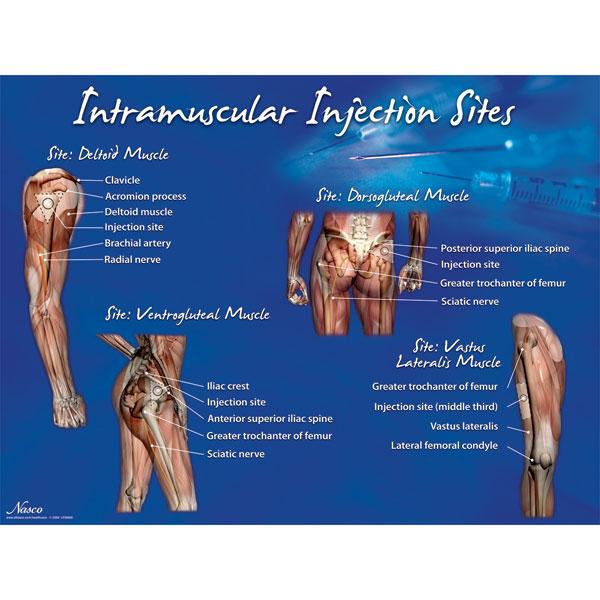 Intramuscular Injection Sites Gluteal Injection Technique 1: